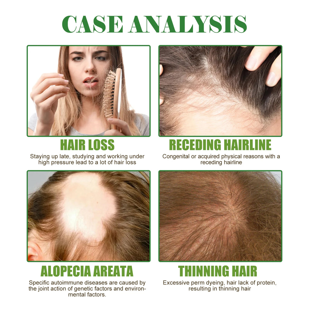 Eelhoe Rosemary Hair Care Series Promote Hair Growth Nourish Strengthen Roots Relieve Scalp Tension Dense Hair Oil With Brush