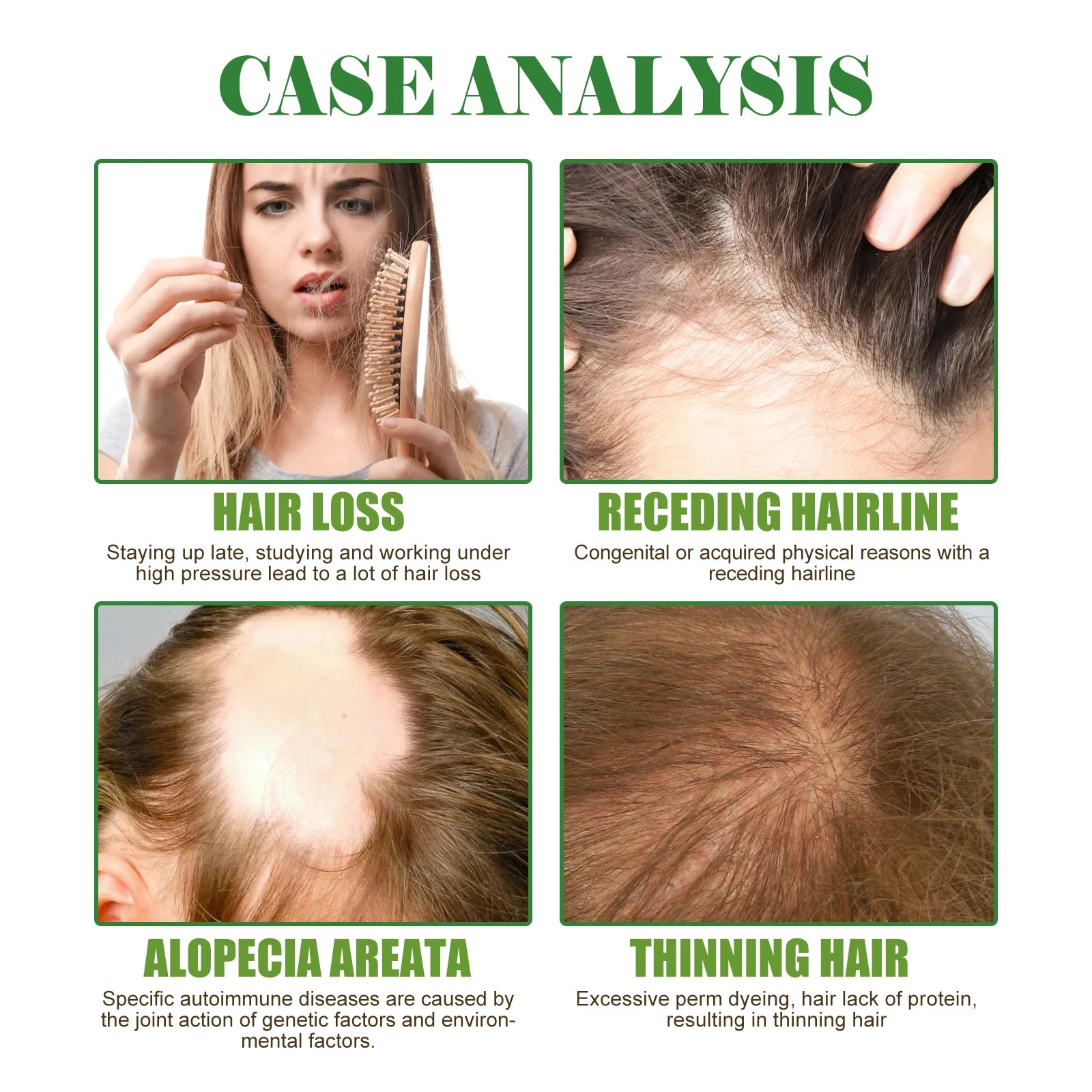 Eelhoe Rosemary Hair Care Series Promote Hair Growth Nourish Strengthen Roots Relieve Scalp Tension Dense Hair Oil With Brush