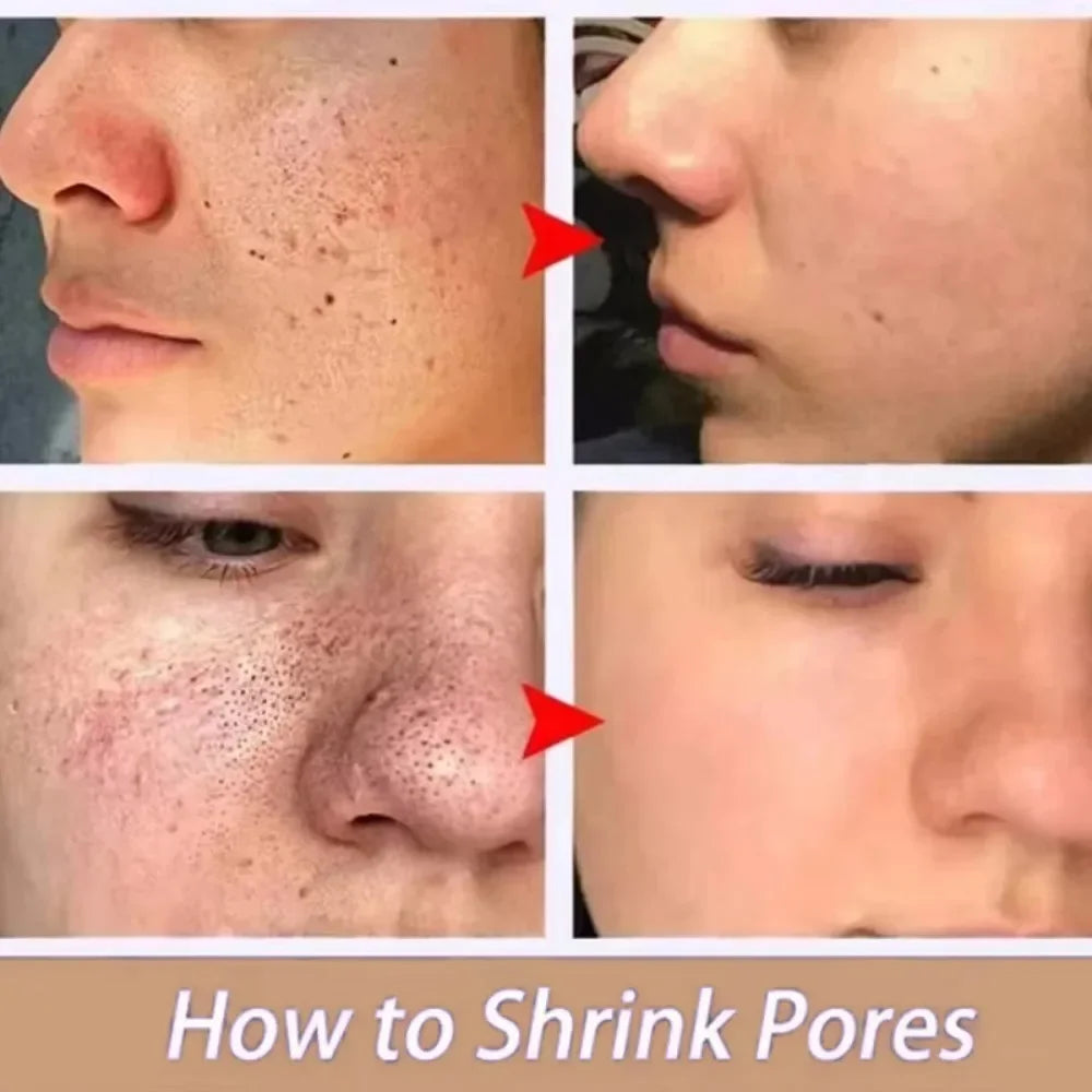 Lactic Acid Large Pores Removal Serum Pore Shrinking Minimizing Essence Moisturizing Firming Smooth Repair Korean Skin Care