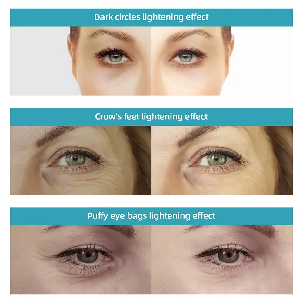 High Frequency Vibration Eye Massager Remove Dark Circles Essence Import Essence import Skin Tighten Eye Care Device